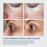 Dark Spot Ampoule